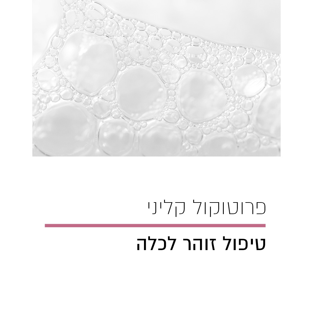 פרוטוקול קליני טיפול זוהר לכלה